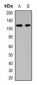 Phospho-MYPT1 (Thr696) Antibody